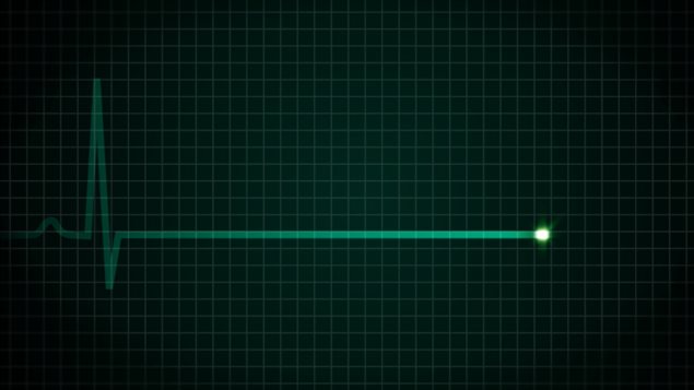 130919_e73lx_encephalogramme-plat_sn635